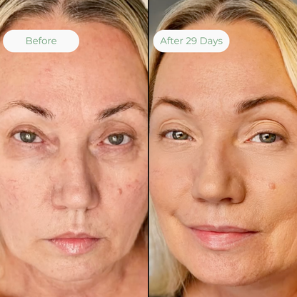 EyeLift Pro